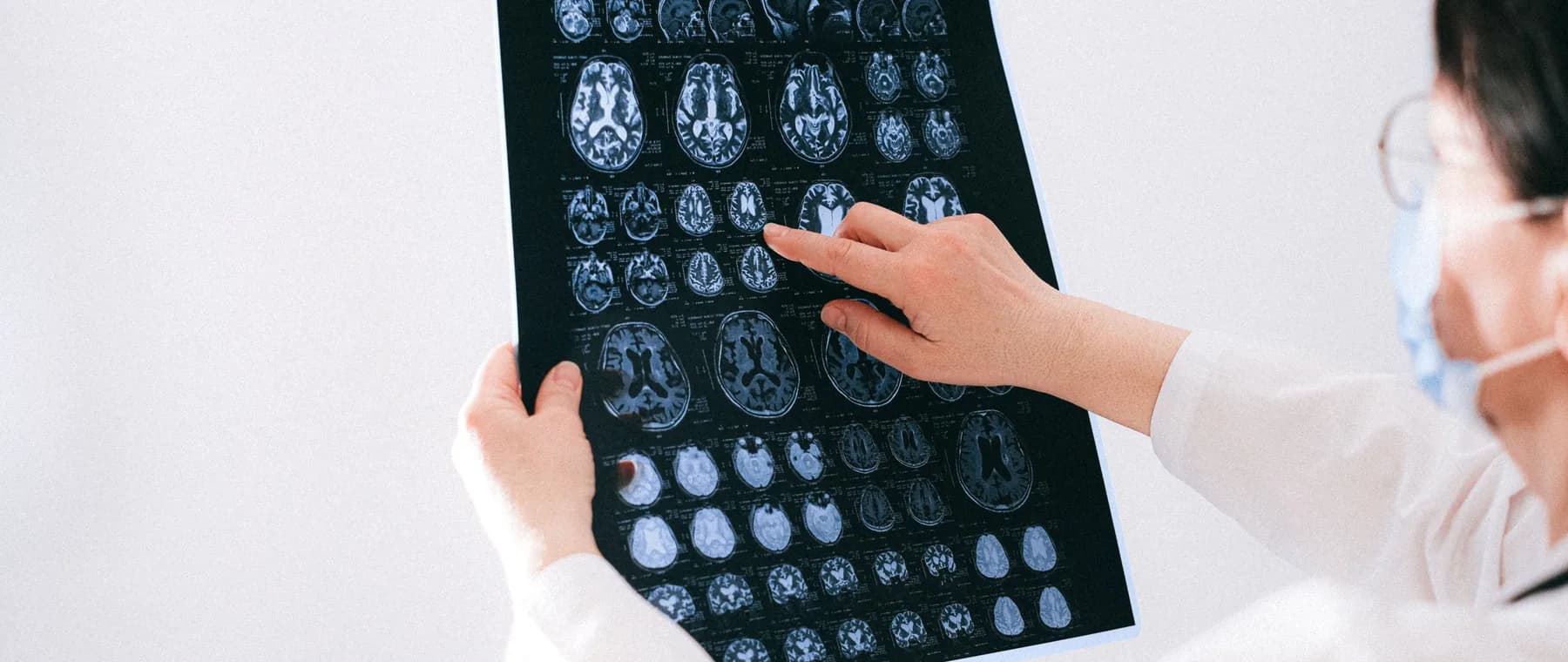 A physician holding an MRI film up to the light to read it