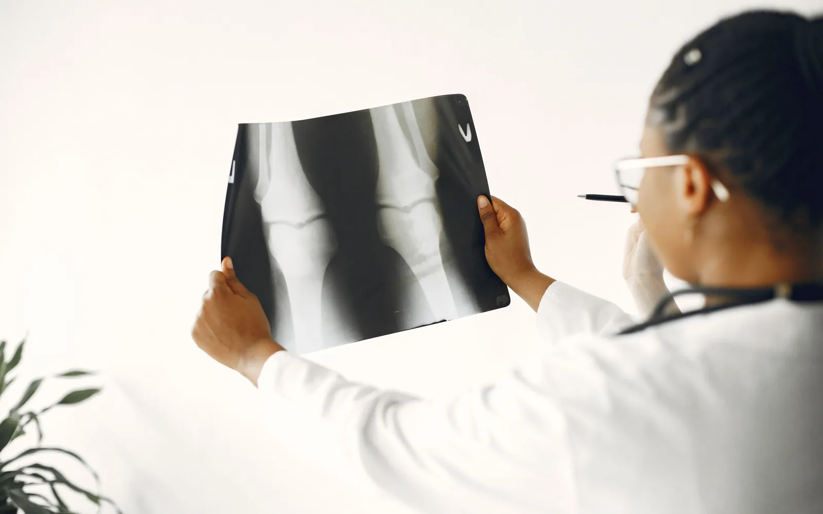 Physician reviewing a knee X-ray