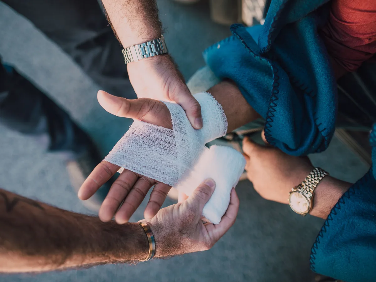 Close-up of two people bandaging an injured hand outdoors, focusing on first aid care.