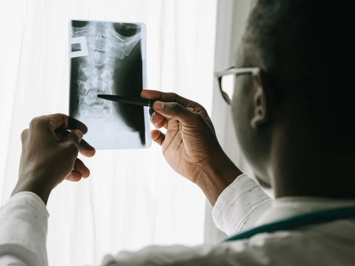 A physician examining a spinal X-ray film