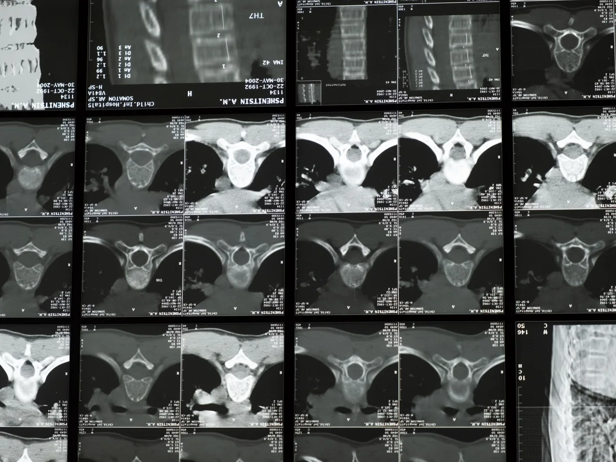High-resolution radiological images showcasing the complex structure of the human spine for medical examination.