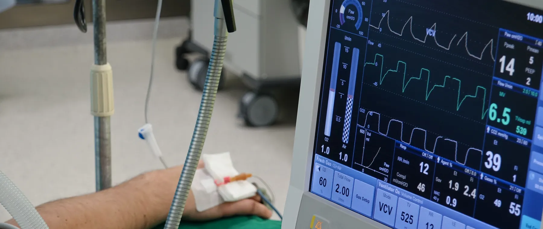 A close-up of a patient's hand connected to medical equipment in an ICU room.