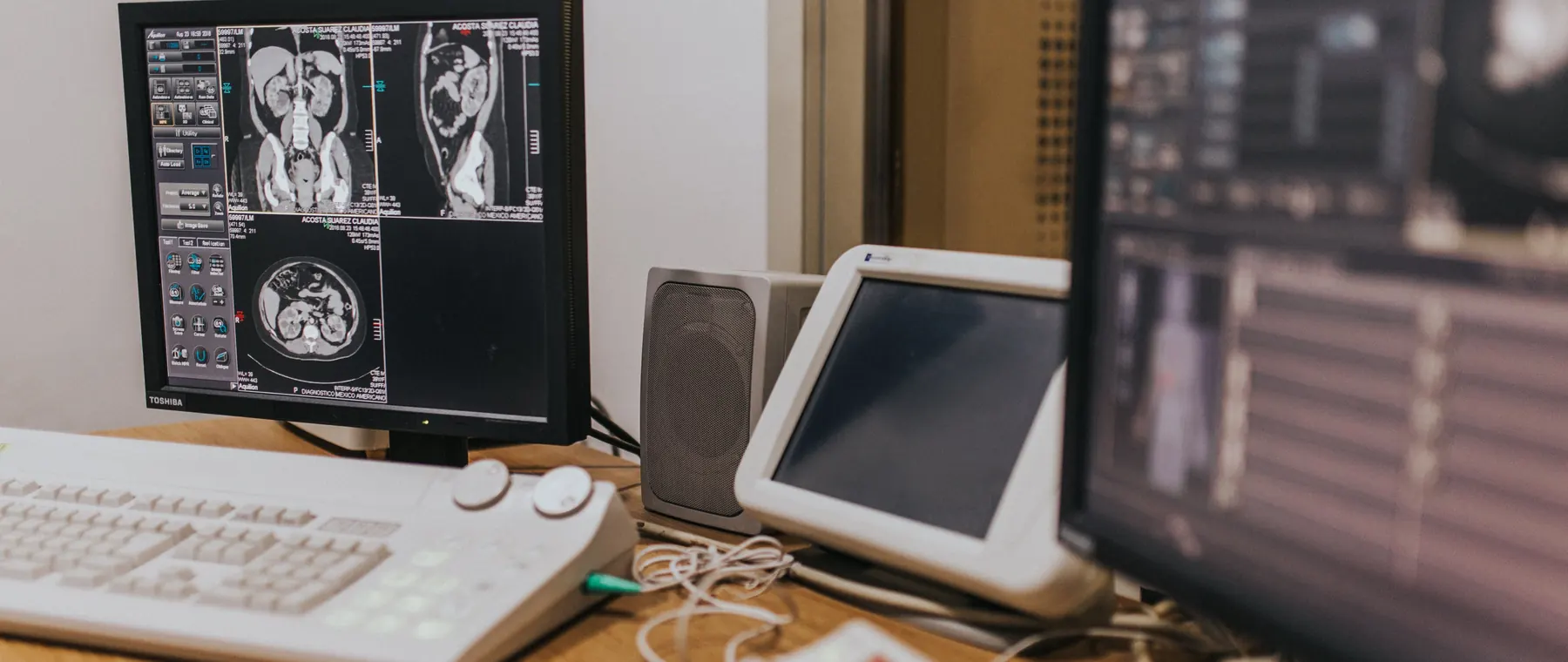 Medical imaging setup with MRI scans on multiple screens in a healthcare facility.