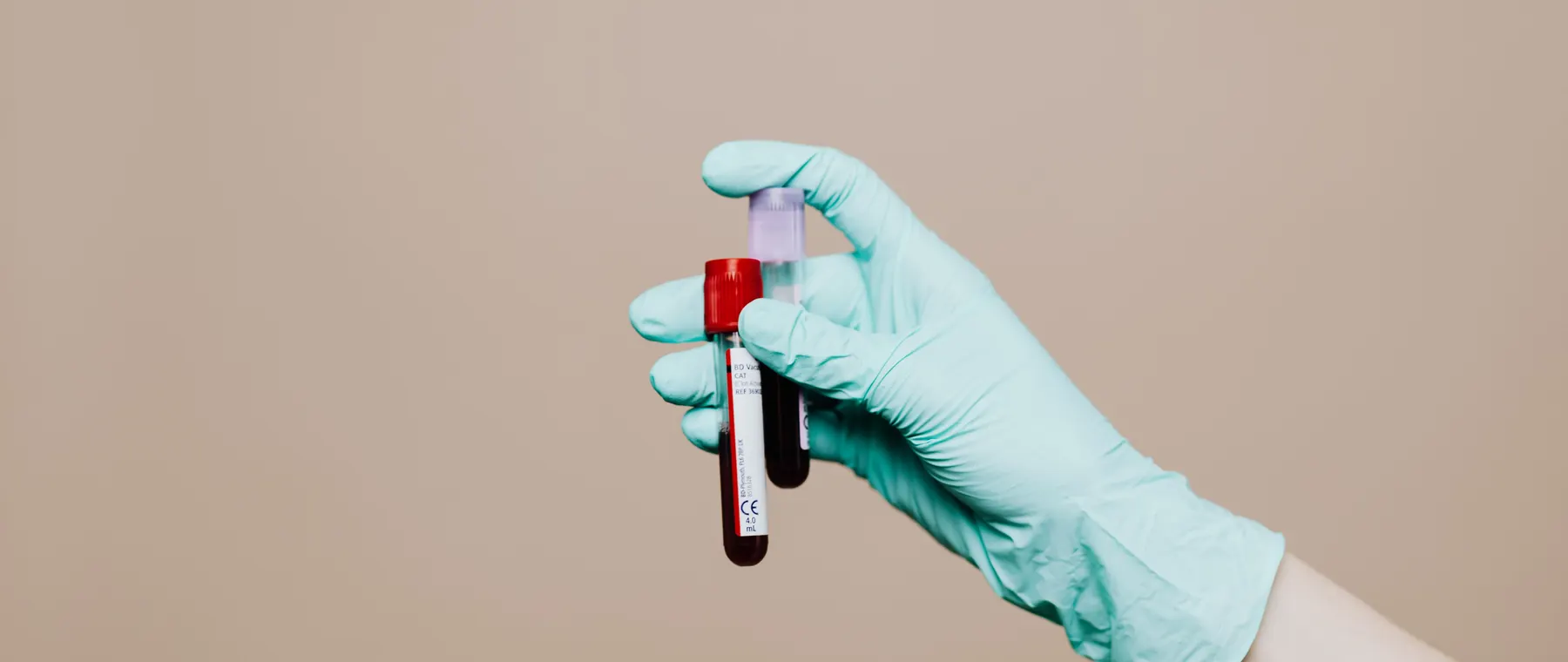 Close-up of a gloved hand holding blood test tubes against neutral background.